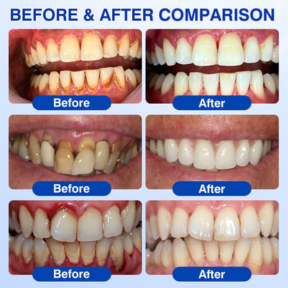 🇬🇧👨‍⚕️🦷CureVivo® GumRevive Periodontal Repair Gel😁