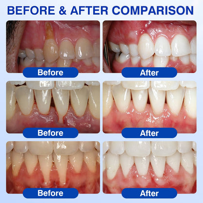 🇬🇧👨‍⚕️🦷CureVivo® GumRevive Periodontal Repair Gel😁
