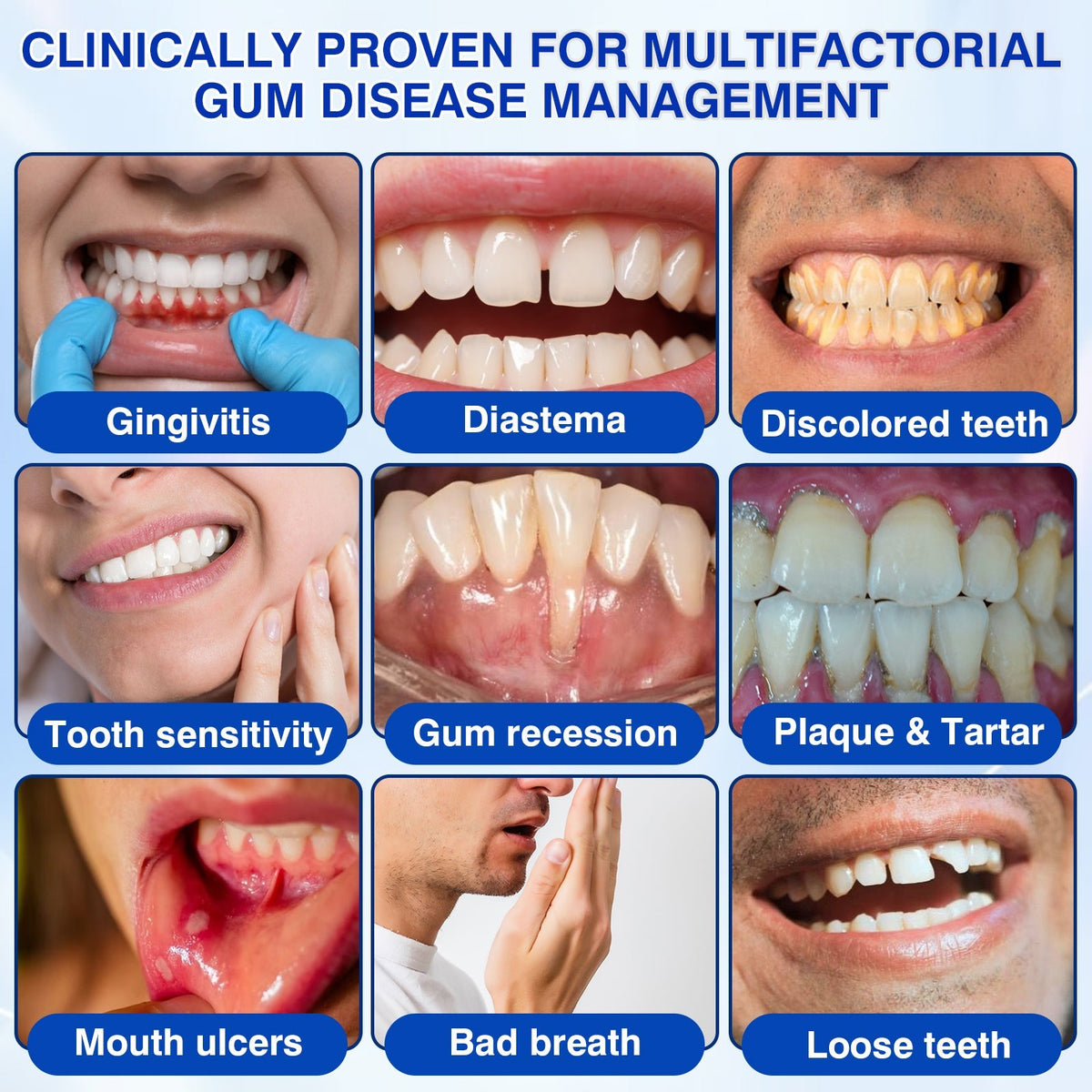 🇬🇧👨‍⚕️🦷CureVivo® GumRevive Periodontal Repair Gel😁