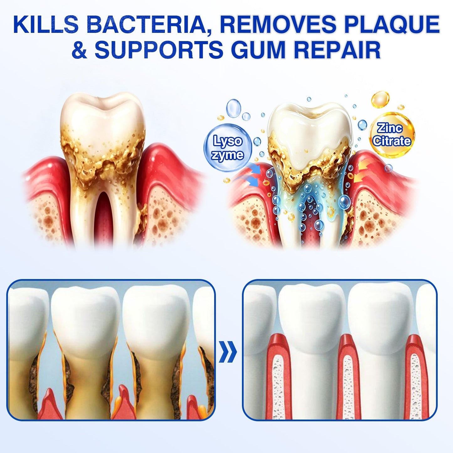 🇬🇧👨‍⚕️🦷CureVivo® GumRevive Periodontal Repair Gel😁