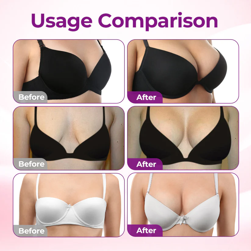 🇬🇧🏆Turonu® ✨BREAST VOLUME BOOST & FIRM Advanced Nano Microneedle Patch🎀