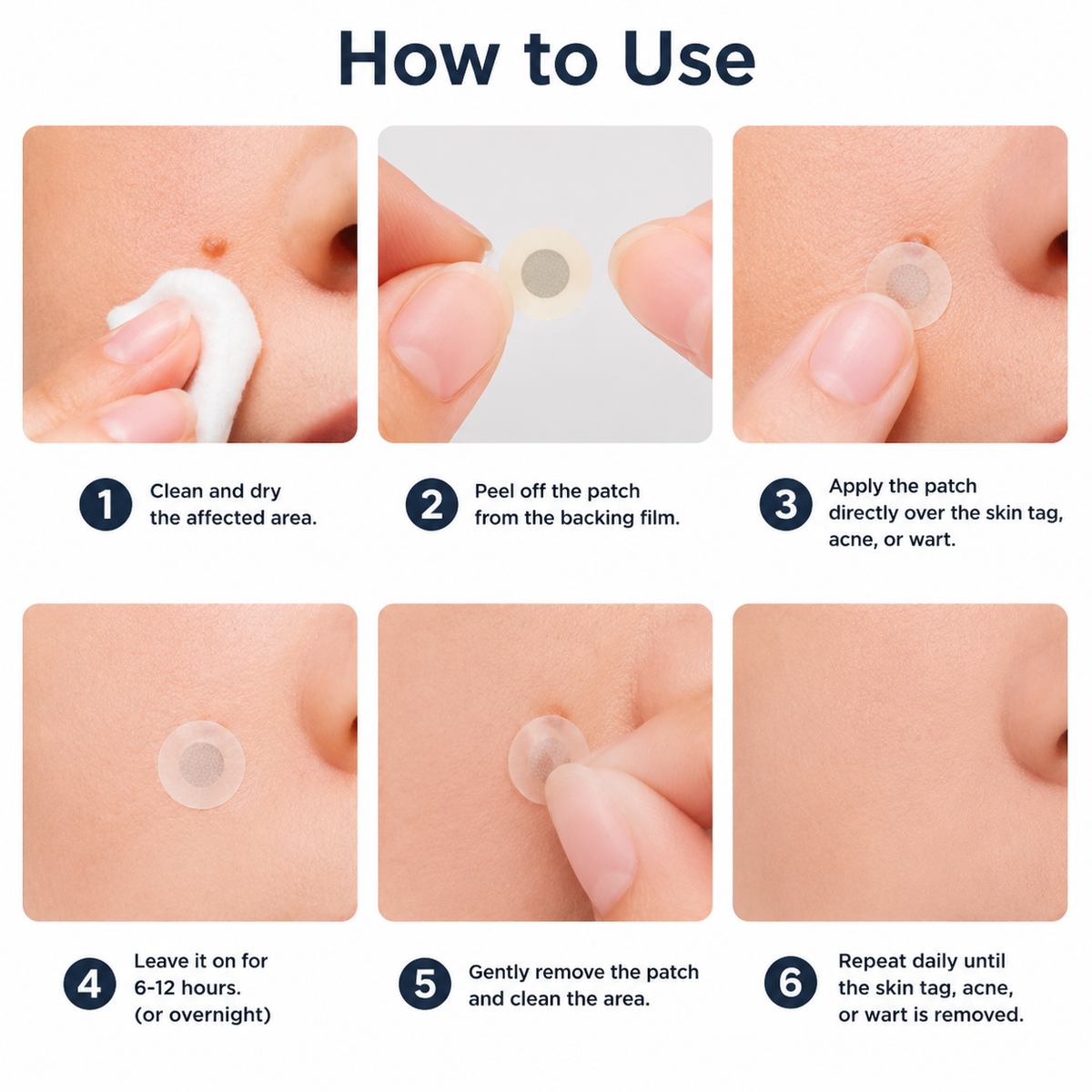 🇬🇧✅𝐇𝐞𝒂𝒍𝗿𝗶𝙯𝙚®2-in-1 Microneedle & Hydrocolloid Patch💫| Removes Raised Moles, Acne, Flat Warts & Skin Tags | Helps Improve Wrinkles, Scars & Blemishes | Invisible Patches for Face & Body
