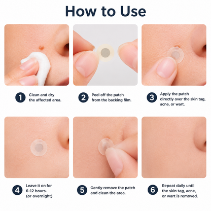 🇬🇧✅𝐇𝐞𝒂𝒍𝗿𝗶𝙯𝙚®2-in-1 Microneedle & Hydrocolloid Patch💫| Removes Raised Moles, Acne, Flat Warts & Skin Tags | Helps Improve Wrinkles, Scars & Blemishes | Invisible Patches for Face & Body